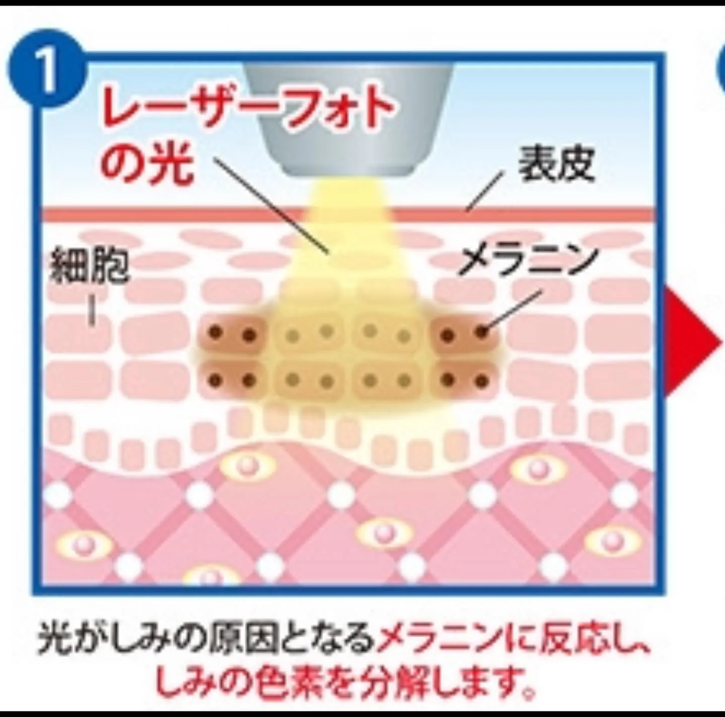 今回は