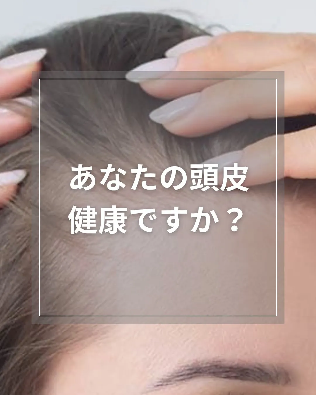 あなたの頭皮健康ですか？