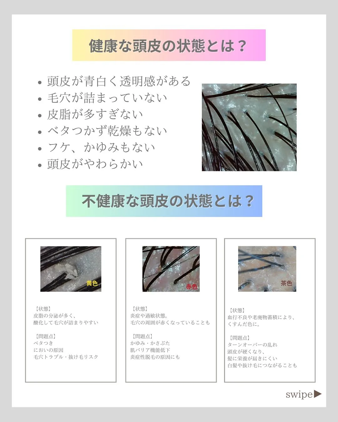 あなたの頭皮健康ですか？